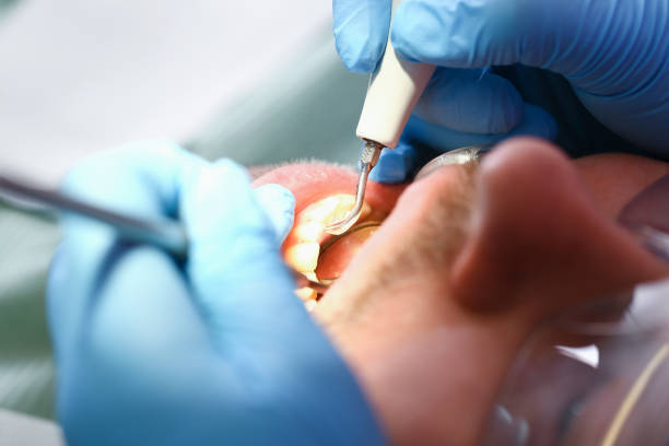 Best Emergency Treatment for Toothache in West Athens, CA